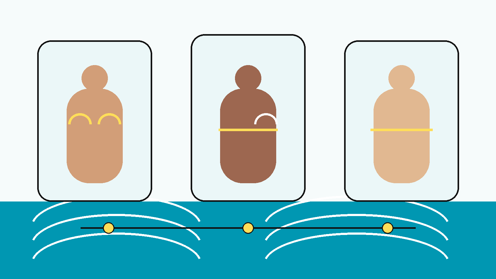 Ilustración conceptual abstracta de varios torsos adultos representados con contornos distintos —reconstrucción, cierre plano y cicatriz— sin detalle anatómico explícito, frente a un horizonte de agua en la paleta NPM.
